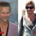 Mickey Rourke Plastic Surgery2