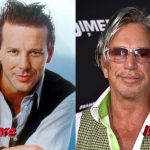 Mickey Rourke Plastic Surgery3