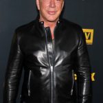 Mickey Rourke after Facelift