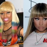 Nicki Minaj Plastic Surgery Before and After2