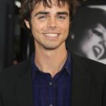 Reid Ewing Cosmetic Surgery 150x150