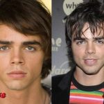 Reid Ewing Plastic Surgery Before and After 150x150