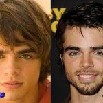 Reid Ewing Plastic Surgery Before and After2 150x150