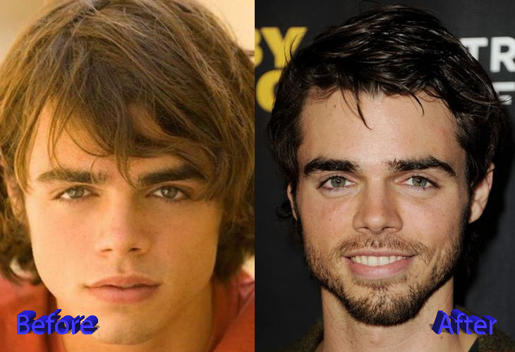 Reid Ewing Plastic Surgery Before and After2