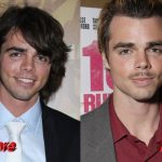 Reid Ewing Plastic Surgery Before and After3 150x150