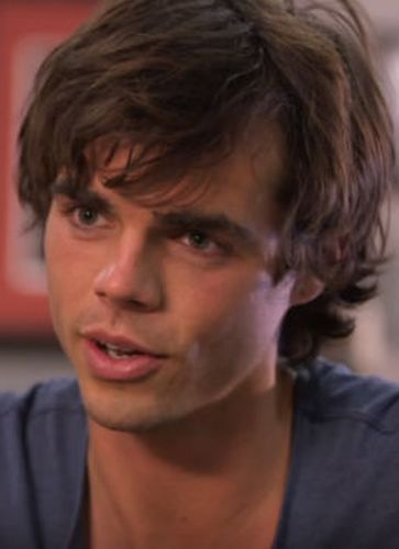 Reid Ewing Plastic Surgery Pictures