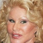 Catwoman After Cosmetic Surgery 150x150 Catwoman After Cosmetic Surgery 150x150
