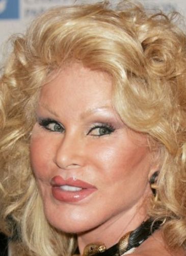 Catwoman After Cosmetic Surgery