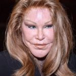 Catwoman After Plastic Surgery 150x150 Catwoman After Plastic Surgery 150x150