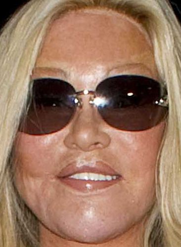 Catwoman After Surgery Disaster