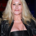 Catwoman Cosmetic Procedures 150x150 Catwoman Cosmetic Procedures 150x150