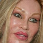 Catwoman Cosmetic Surgery Fail 150x150 Catwoman Cosmetic Surgery Fail 150x150