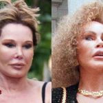 Catwoman Plastic Surgery Before and After2 150x150 Catwoman Plastic Surgery Before and After2 150x150