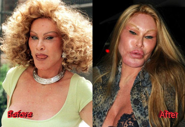 Catwoman Plastic Surgery From Bad to Worse Plastic Surgery Mistakes
