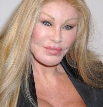 Catwoman Plastic Surgery: From Bad to Worse