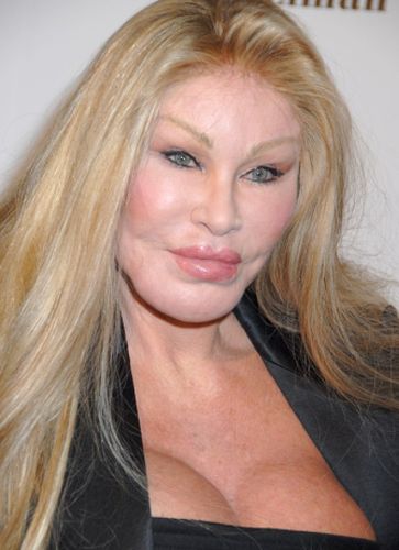 Catwoman Plastic Surgery: From Bad to Worse