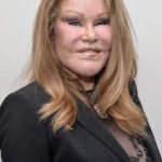 Catwoman Plastic Surgery Gone wrong 150x150 Catwoman Plastic Surgery Gone wrong 150x150