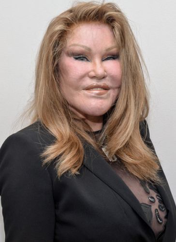 Catwoman Plastic Surgery Gone wrong