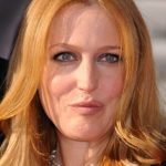Gillian Anderson After Surgery Photos 150x150