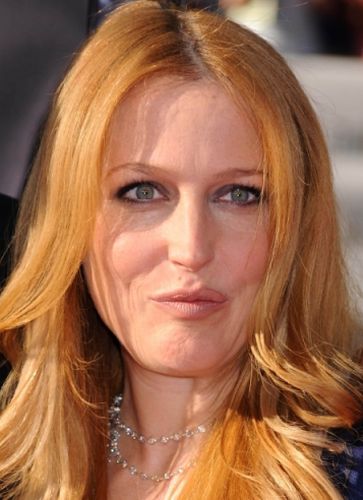 Gillian Anderson After Surgery Photos