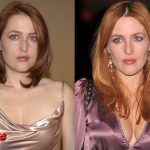 Gillian Anderson Plastic Surgery Before and After 150x150