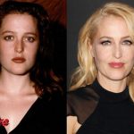 Gillian Anderson Plastic Surgery Before and After2 150x150