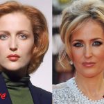 Gillian Anderson Plastic Surgery Before and After3 150x150