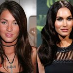 Megan Fox Plastic Surgery Before and After