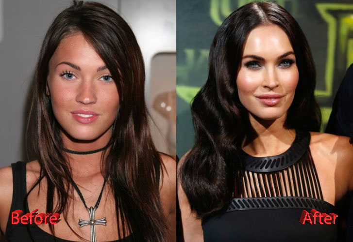 Megan Fox Plastic Surgery Before and After