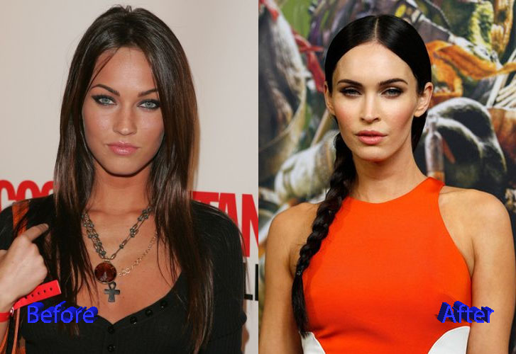 Megan Fox Plastic Surgery Before and After2