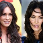 Megan Fox Plastic Surgery Before and After3