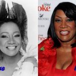 Patti Labelle Before and After Surgery Photo 150x150
