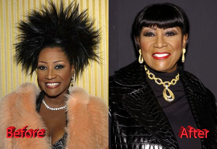 Patti Labelle Surgery Transformation