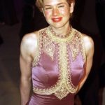 Renee Zellweger Before Plastic Surgery 150x150