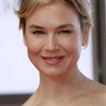 Renee Zellweger Before Surgery Procedure 150x150
