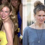 Renee Zellweger Plastic Surgery Before and After