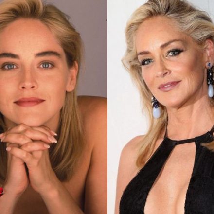 sharon stone plastic surgery Image 9