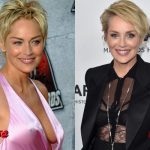 Sharon Stone Before and After Surgery Photo 150x150