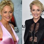 Sharon Stone Before and After Surgery Photo