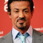 Sylvester Stallone After Plastic Surgery 150x150