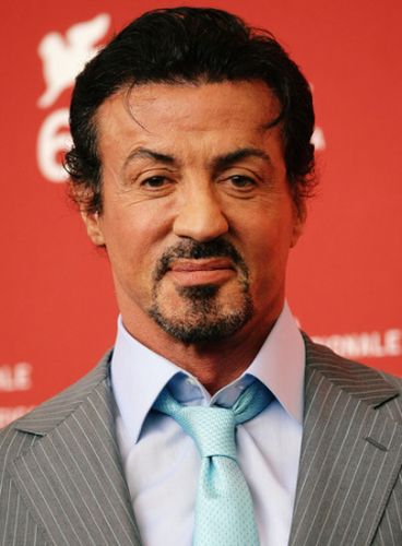 Sylvester Stallone After Plastic Surgery
