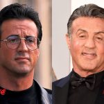 Sylvester Stallone Before and After Cosmetic Procedure 150x150