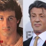 Sylvester Stallone Plastic Surgery Before and After 150x150