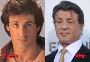 Sylvester Stallone Plastic Surgery: A New Rocky? - Plastic Surgery Mistakes