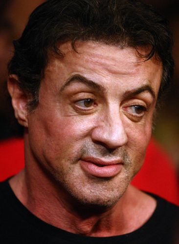 Sylvester Stallone Plastic Surgery Gossips