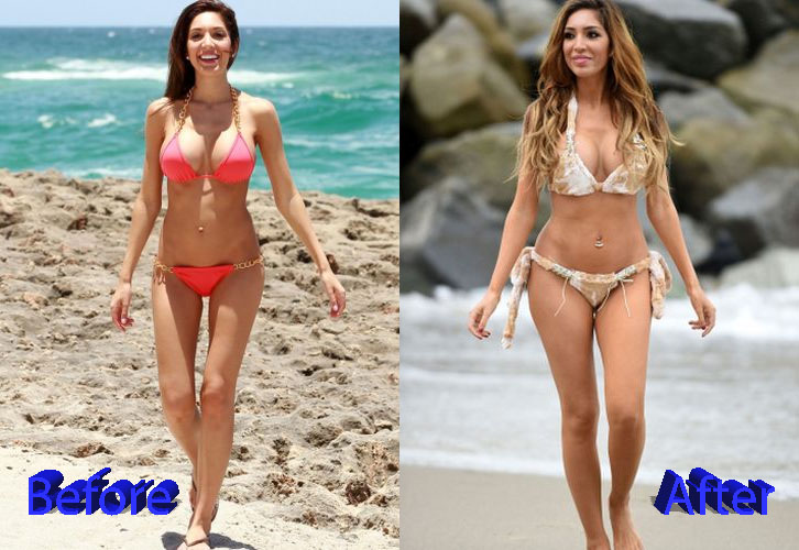 Farrah Abraham Before and After Cosmetic Surgery