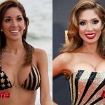 Farrah Abraham Before and After Surgery Transformation 150x150