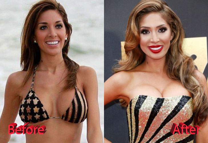 Farrah Abraham Before and After Surgery Transformation