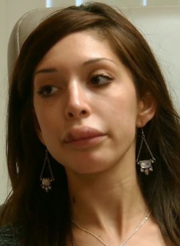 Farrah Abraham Failed Lip Job