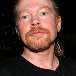 Axl Rose After Cosmetic Surgery